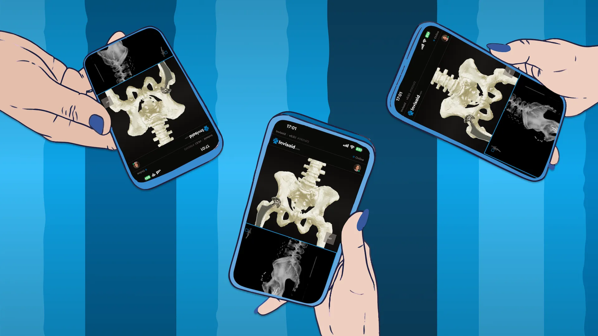 An illustration of three hands holding three distinct smartphones running the Invisaid app.